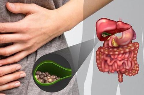 Polyp túi mật khi nào cần điều trị?