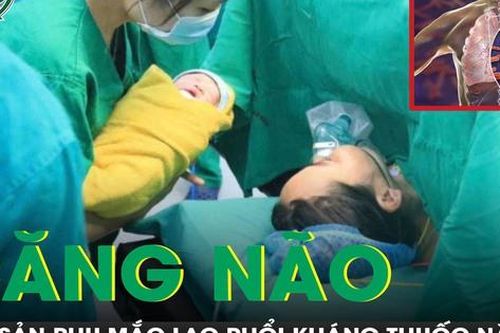 Mổ lấy thai cho sản phụ mắc lao phổi kháng thuốc, biến chứng suy hô hấp
