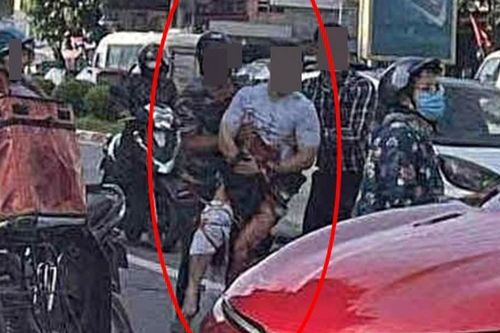 Tiktoker có tiếng ở Thái Nguyên bị chém đứt bàn tay trên đường
