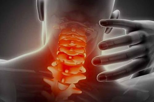 Đau cổ vai gáy có thể bị liệt nếu điều trị sai cách