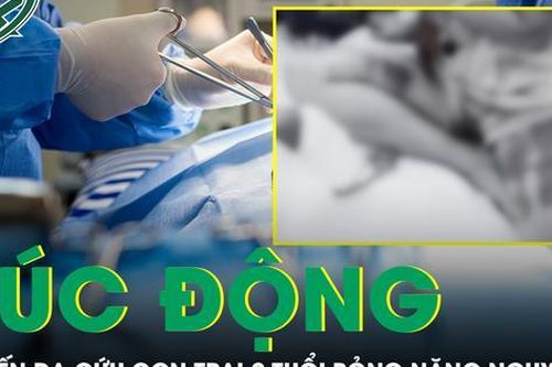 Xúc động câu chuyện mẹ hiến da cứu con trai 2 tuổi bỏng nặng nguy kịch