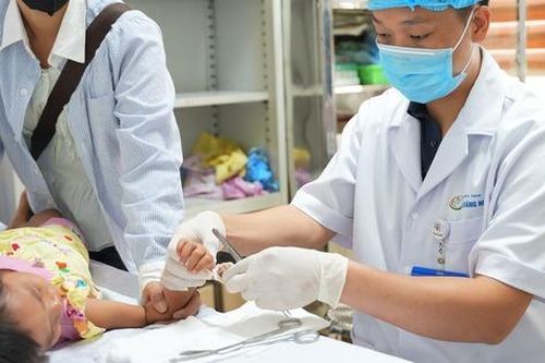 Bị bỏng điện nặng, bé gái dân tộc suýt bị tháo bỏ ngón tay