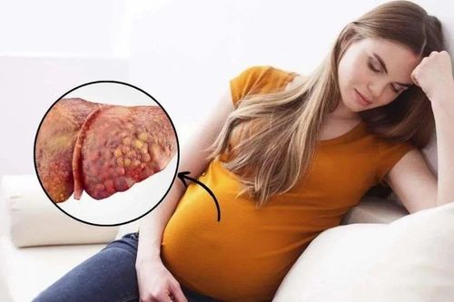 Cuộc chạy đua với tử thần cứu sản phụ hôn mê sau sinh