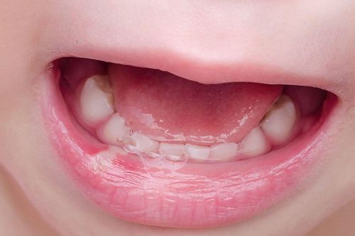 Tập đánh răng từ sớm giúp bé có hàm răng chắc khỏe lâu dài