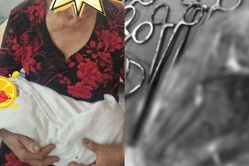 Vừa sinh con xong, bác sĩ hoảng hốt phát hiện thêm một 'đứa trẻ' trong bụng sản phụ