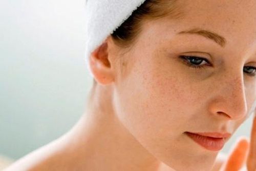 Nám và tàn nhang phân biệt thế nào?