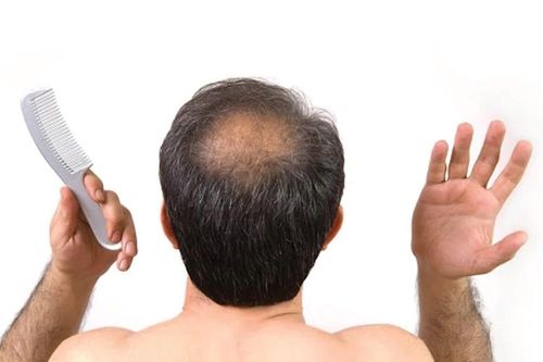 Nghiên cứu mới, đường deoxyribose có thể kích thích mọc tóc