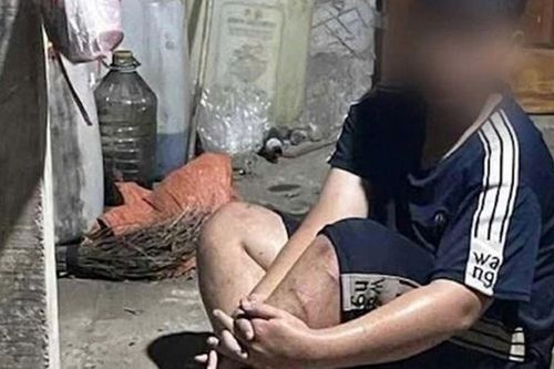 Đằng sau tiếng la hét thất thanh, nam sinh ở Huế bị xích chân, hành hung giữa đêm