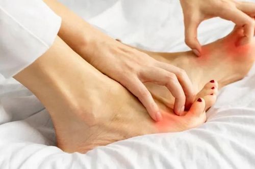 3 dấu hiệu tổn thương thận thường xuất hiện vào ban đêm