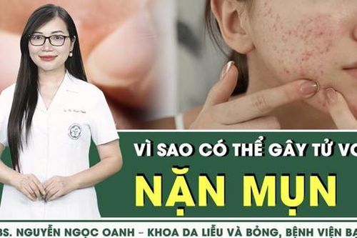 Vì sao nặn mụn có thể gây tử vong?