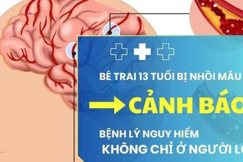 Bé trai 13 tuổi bị nhồi máu não: Cảnh báo bệnh lý nguy hiểm không chỉ ở người lớn