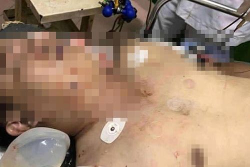 Đang ngồi nhậu trong nhà, người đàn ông nghi trúng đạn tử vong