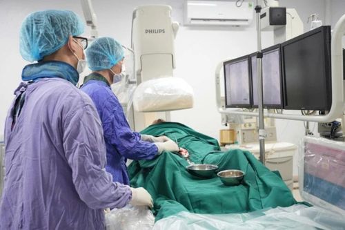 Đột quỵ do hẹp động mạch cảnh trong kèm mạch máu lồi