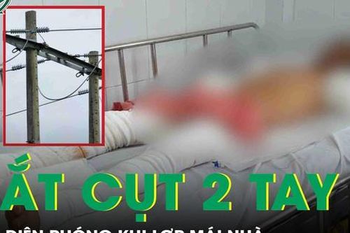 Bị điện phóng lúc lợp mái nhà, người đàn ông trả giá đắt khi phải cắt cụt 2 tay