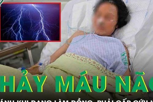 Chảy máu não vì sét đánh khi đang làm đồng, người phụ nữ nguy kịch phải cấp cứu khẩn