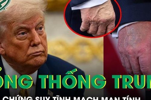Nhà Trắng lên tiếng về chứng suy tĩnh mạch của Tổng thống Trump