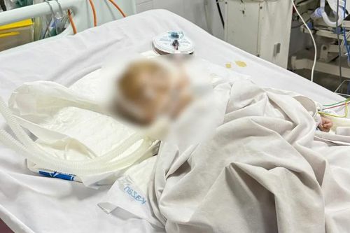 Điều tra vụ bé trai xuất huyết não bất thường tại một điểm giữ trẻ tự phát