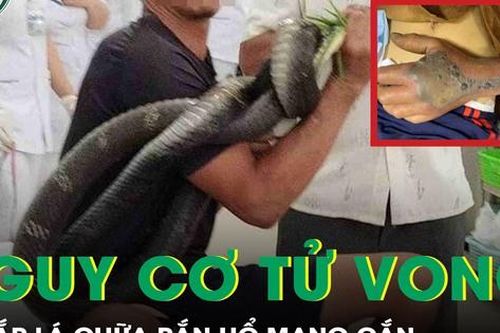 Đắp lá khi bị rắn hổ mang chúa cắn, người đàn ông ngừng tim, nguy cơ tử vong cao