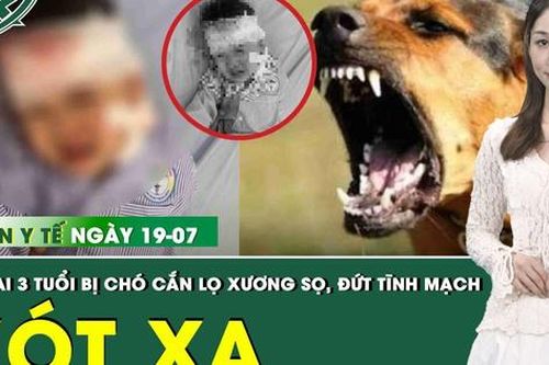 Bản tin Y tế 19/7: Bé trai 3 tuổi bị chó cắn lộ xương sọ, đứt tĩnh mạch