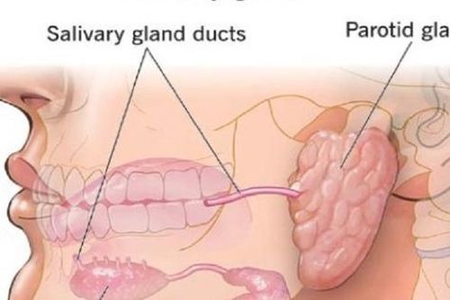 Đi khám định kỳ, người đàn ông 54 tuổi tình cờ phát hiện u tuyến nước bọt