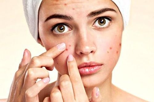 Cách xử lý mụn trứng cá, phục hồi làn da khỏe mạnh sau mụn