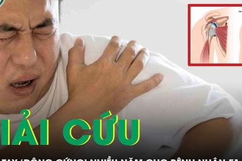 Giải cứu cánh tay 'đông cứng' suốt nhiều năm cho bệnh nhân 51 tuổi