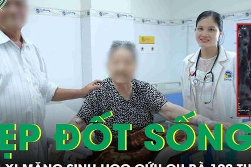 Cụ bà 102 tuổi ngã xẹp đốt sống được điều trị thành công nhờ bơm xi măng sinh học