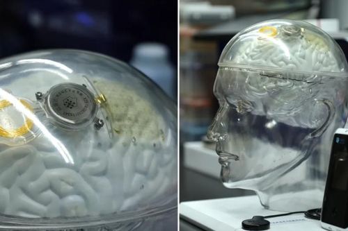 Trung Quốc đuổi sát Mỹ trong công nghệ não bộ, sánh ngang Neuralink