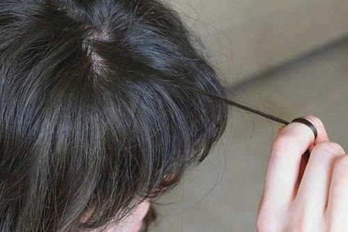 Nuốt tóc nhiều năm không biết, bé gái nhập viện với khối tóc dài hơn 20cm trong dạ dày