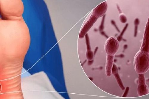 Chủ quan với vết thương nhỏ có thể mắc uốn ván nguy hiểm
