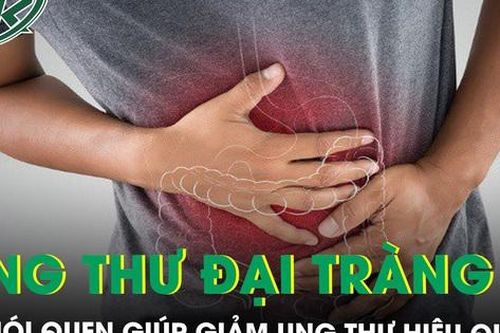 Thay đổi lối sống với 5 thói quen giúp giảm nguy cơ ung thư đại tràng