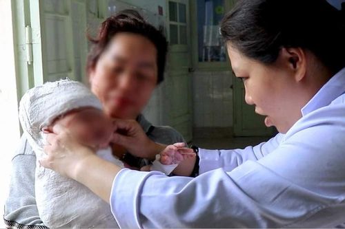 Phát hiện sớm đám rối thần kinh cánh tay ở trẻ sơ sinh để phục hồi