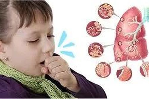 TPHCM ghi nhận một trường hợp mắc bệnh ho gà