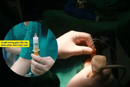 Đau vai kéo dài tưởng ung thư không ngờ khớp vai đông cứng