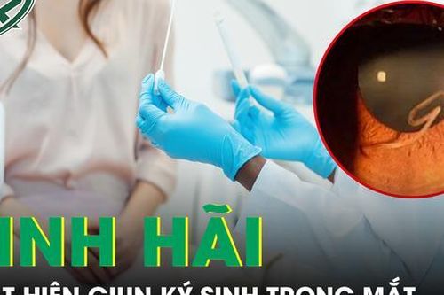 Mắt bị cộm, người phụ nữ tá hỏa phát hiện giun dài 4cm ký sinh trong mắt
