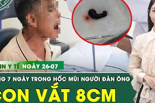Bản Tin Y Tế 26/7: Phát hiện con vắt 8cm còn sống trong hốc mũi người đàn ông