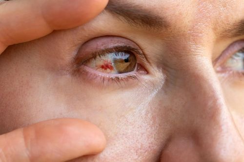 Bất thường ở mắt cảnh báo bệnh