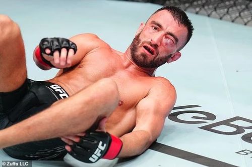 Mặt võ sĩ MMA biến dạng vì đòn nặng