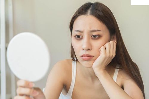 Nguyên nhân khiến mắt thâm quầng mà ít người biết