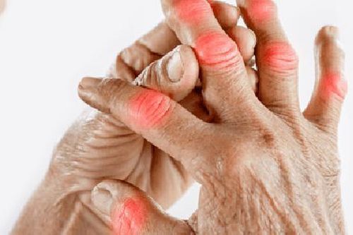 7 loại củ quả có lợi cho người bệnh viêm khớp dạng thấp