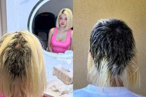 'DJ gợi cảm nhất Hàn Quốc' Soda suy sụp vì bộ tóc lởm chởm
