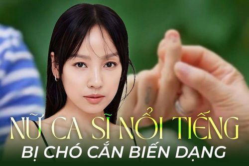 Nữ ca sĩ nổi tiếng bị biến dạng một bộ phận cơ thể vì chó cắn, hình ảnh khiến ai cũng đau lòng