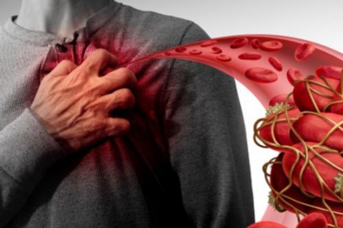 Bác sĩ tim mạch cảnh báo, mối nguy thầm lặng ảnh hưởng tính mạng từ thói quen đơn giản