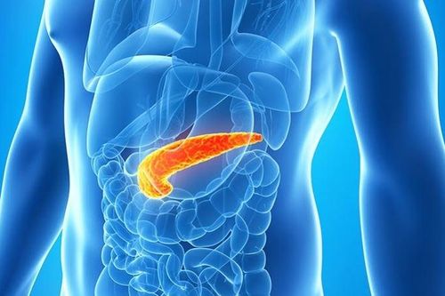 5 bất thường có thể là biểu hiện của ung thư tuyến tụy giai đoạn đầu