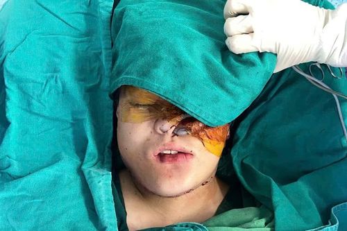 Hành trình nhân đạo loại bỏ khối u 'khổng lồ' tái tạo mặt cho bé gái 16 tuổi