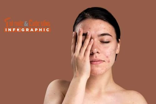 [INFOGRAPHIC] Những vấn đề về da thường gặp trong mùa hè