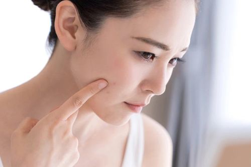 Bí quyết để có làn da trẻ mãi tuổi đôi mươi dù đã vượt ngưỡng 30+