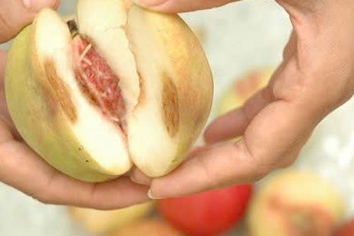 Vợ chồng buôn hoa quả mắc ung thư gan vì thói quen ăn đồ mốc