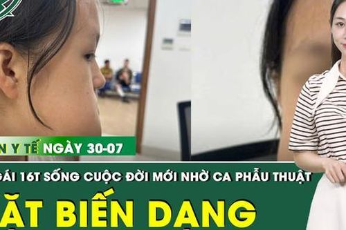 Bản Tin Y Tế 30/7: Tái tạo gương mặt biến dạng cho cô gái 16 tuổi do khối u lớn