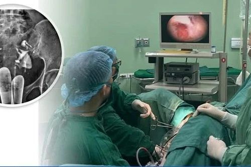 Tách dính buồng tử cung mang lại hy vọng cho người mẹ 10 năm mong con